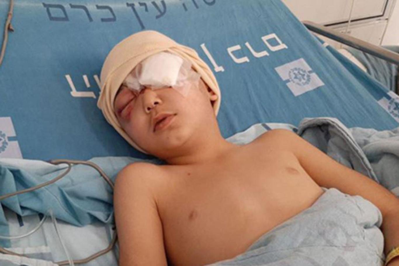8 yaşındaki Filistinli çocuk, siyonist teröristlerin açtığı ateş sonucu gözünü kaybetti
